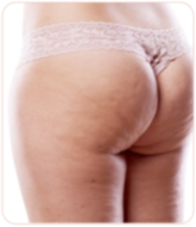 Woman legs before massages